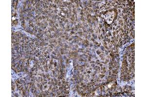 IHC analysis of TRBP/TARBP2 using anti-TRBP/TARBP2 antibody (ABIN7600548). (TARBP2 Antikörper  (AA 20-366))