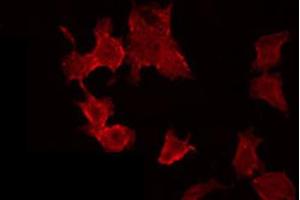 ABIN6272400 staining MCF7 by IF/ICC. (POTE-14/22 Antikörper)