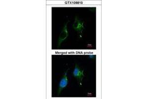 Image no. 2 for anti-Natriuretic Peptide Receptor A/guanylate Cyclase A (Atrionatriuretic Peptide Receptor A) (NPR1) (AA 640-886) antibody (ABIN467522)