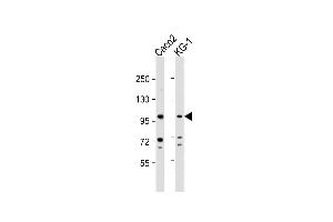 All lanes : Anti-CSF3R Antibody (Center) at 1:1000 dilution Lane 1: Caco2 whole cell lysate Lane 2: KG-1 whole cell lysate Lysates/proteins at 20 μg per lane.
