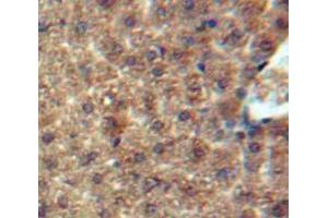 Used in DAB staining on fromalin fixed paraffin-embedded Liver tissue (CCL7 Antikörper  (AA 24-99))