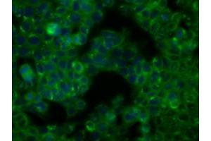 Image no. 2 for anti-Bruton Agammaglobulinemia tyrosine Kinase (BTK) antibody (ABIN1496974) (BTK Antikörper)