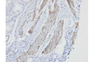 IHC-P Image Immunohistochemical analysis of paraffin-embedded human smooth muscle, using GOLGA5, antibody at 1:100 dilution.