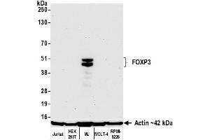 Western Blotting (WB) image for anti-Forkhead Box P3 (FOXP3) (AA 275-325) antibody (ABIN7795681)