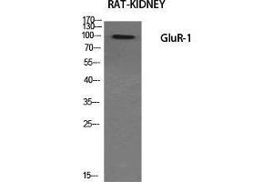 Western Blot (WB) analysis of specific cells using GluR-1 Polyclonal Antibody. (Glutamate Receptor 1 Antikörper  (Ser43))