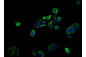 Immunofluorescence staining of MCF-7 cells with ABIN7163222 at 1:100, counter-stained with DAPI. (PIGQ Antikörper  (AA 616-760))