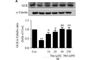 Paeonol regulated the phosphorylation of Akt and the protein contents of GCK and LDLR in insulin-resistant HepG2 cells. (GCK Antikörper  (AA 1-300))