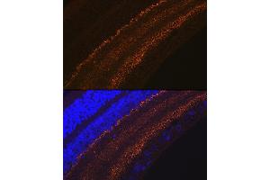 Immunofluorescence analysis of rat retina using G Rabbit mAb (ABIN7267515) at dilution of 1:100 (40x lens). (GAP43 Antikörper)