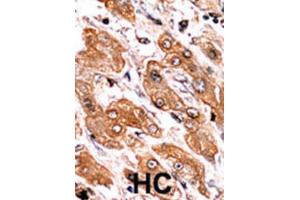Immunohistochemistry (IHC) image for anti-BCL2-Interacting Killer (Apoptosis-Inducing) (BIK) (pThr33) antibody (ABIN2970932) (BIK Antikörper  (pThr33))