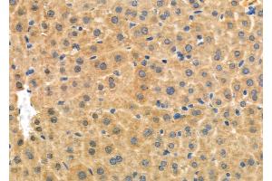 ABIN6264567 and ABIN6276965 at 1/100 staining Mouse liver tissue by IHC-P. (RAB27A Antikörper  (C-Term))