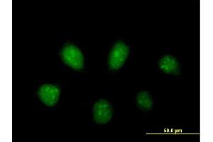Immunofluorescence of purified MaxPab antibody to PARP3 on HeLa cell. (PARP3 Antikörper  (AA 1-533))