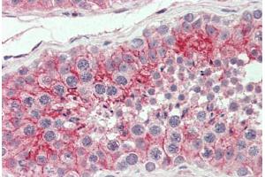 Anti-CXADR antibody  ABIN960759 IHC staining of human testis. (Coxsackie Adenovirus Receptor Antikörper  (Internal Region))