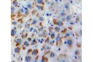 Used in DAB staining on fromalin fixed paraffin-embedded Liver tissue (Melatonin Receptor 1A Antikörper  (AA 300-353))