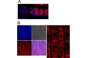 Image no. 2 for anti-Heat Shock 70kDa Protein 5 (Glucose-Regulated Protein, 78kDa) (HSPA5) antibody (ABIN349665) (GRP78 Antikörper)
