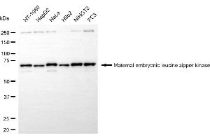anti-Maternal Embryonic Leucine Zipper Kinase (MELK) antibody