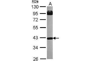 WB Image Sample (30 ug of whole cell lysate) A: NT2D1 10% SDS PAGE antibody diluted at 1:1000 (INPP5A Antikörper)