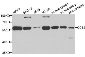 Western blot analysis of extracts of various cell lines, using CCT2 antibody (ABIN5973929) at 1/1000 dilution. (CCT2 Antikörper)