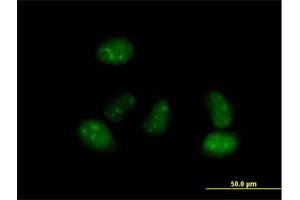 Immunofluorescence of purified MaxPab antibody to ALS2CR15 on HeLa cell. (ICA1L Antikörper  (AA 1-482))
