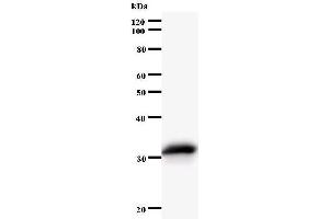 Western Blotting (WB) image for anti-N(alpha)-Acetyltransferase 15, NatA Auxiliary Subunit (NAA15) antibody (ABIN933132) (NAA15 Antikörper)