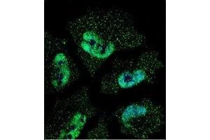 Confocal immunofluorescent analysis of HuR antibody with NCI-H460 cells followed by Alexa Fluor 488-conjugated goat anti-mouse lgG (green). (ELAVL1 Antikörper)