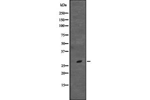 Western blot analysis of CD48 expression in Jurkat cell lysate,The lane on the left is treated with the antigen-specific peptide. (CD48 Antikörper  (Internal Region))