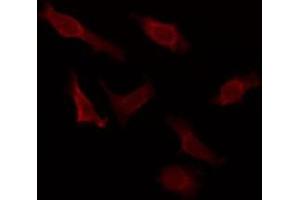 ABIN6276048 staining HuvEc by IF/ICC. (MCHR2 Antikörper  (C-Term))