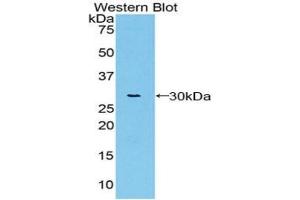 Detection of Recombinant vWA1, Rat using Polyclonal Antibody to Von Willebrand Factor A Domain Containing Protein 1 (vWA1) (VWA1 Antikörper  (AA 43-285))