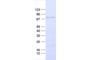 Western Blotting (WB) image for BRCA1 Associated Protein (BRAP) protein (His tag) (ABIN2715326)
