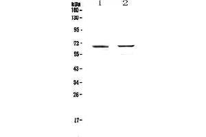 Western Blotting (WB) image for anti-Runt-Related Transcription Factor 1, Translocated To, 1 (Cyclin D-Related) (RUNX1T1) (AA 335-510) antibody (ABIN5693284)