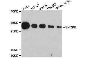Western blot analysis of extracts of various cell lines, using SNRPB antibody (ABIN5995789) at 1:3000 dilution. (SNRPB Antikörper)