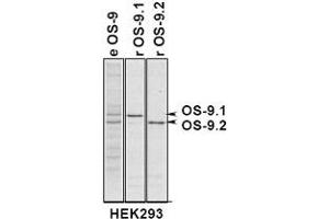 Immunoprecipitation of OS9 in 293 cells expressing OS9. (OS9 Antikörper  (AA 300-400))