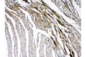 IHC testing of FFPE mouse heart tissue with GJC1 antibody at 1ug/ml. (GJC1 Antikörper  (AA 91-131))