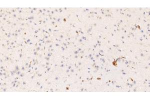 Detection of HRG in Rat Cerebrum Tissue using Monoclonal Antibody to Histidine Rich Glycoprotein (HRG) (HRG Antikörper  (AA 19-525))