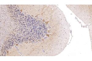 Detection of CALB in Human Cerebellum Tissue using Polyclonal Antibody to Calbindin (CALB) (CALB1 Antikörper  (AA 3-261))