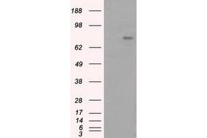 Image no. 7 for anti-Bruton Agammaglobulinemia tyrosine Kinase (BTK) antibody (ABIN1496974) (BTK Antikörper)