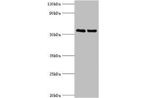 Western blot All lanes: TRIM27 antibody at 4 μg/mL Lane 1: Jurkat whole cell lysate Lane 2: HepG2 whole cell lysate Secondary Goat polyclonal to rabbit IgG at 1/10000 dilution Predicted band size: 59, 42 kDa Observed band size: 59 kDa (TRIM27 Antikörper  (AA 214-513))