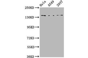 Western Blot Positive WB detected in: Hela whole cell lysate, A549 whole cell lysate, 293T whole cell lysate All lanes: CNGB1 antibody at 4. (GARP Antikörper  (AA 131-253))
