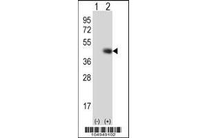 Western blot analysis of TPST1 using rabbit polyclonal TPST1 Antibody (K351) using 293 cell lysates (2 ug/lane) either nontransfected (Lane 1) or transiently transfected (Lane 2) with the TPST1 gene. (TPST1 Antikörper  (C-Term))