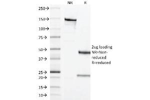 SDS-PAGE Analysis of Purified CD68 Mouse Monoclonal Antibody ABIN6383883. (CD68 Antikörper  (Extracellular Domain))