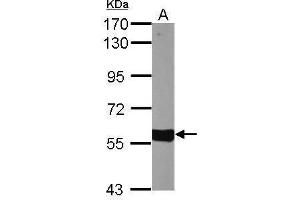 Western Blotting (WB) image for anti-Cytochrome P450, Family 27, Subfamily A, Polypeptide 1 (CYP27A1) (Center) antibody (ABIN2855688)