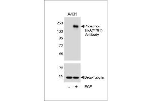Western Blotting (WB) image for anti-Neurotrophic Tyrosine Kinase, Receptor, Type 1 (NTRK1) (pTyr791) antibody (ABIN389679)