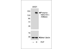 Western blot analysis of lysates from A431 cell line, untreated or treated with EGF, 100 ng/mL, using Phospho-TrkA Antibody (ABIN389679 and ABIN2839650) (upper) or Beta-Tubulin (lower). (TRKA Antikörper  (pTyr791))