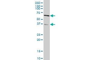 SMAD3 monoclonal antibody (M21), clone 2G4 Western Blot analysis of SMAD3 expression in HeLa . (SMAD3 Antikörper  (AA 147-270))