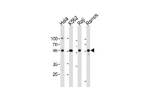RELA Antibody (Center) (ABIN1881740 and ABIN2838805) western blot analysis in Hela,K562,Raji,Ramos cell line lysates (35 μg/lane). (NF-kB p65 Antikörper  (AA 166-195))
