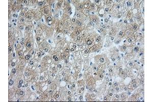 Image no. 10 for anti-Acetyl-CoA Acetyltransferase 2 (ACAT2) antibody (ABIN1496401) (ACAT2 Antikörper)