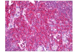 Image no. 1 for anti-Synaptosomal-Associated Protein, 23kDa (SNAP23) antibody (ABIN347011) (SNAP23 Antikörper)