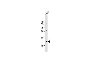 Anti-B2M Antibody (N-term) at 1:1000 dilution + Hela whole cell lysate Lysates/proteins at 20 μg per lane. (beta-2 Microglobulin Antikörper  (N-Term))