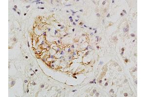 Formalin-fixed and paraffin embedded human kidney labeled with Rabbit Anti-PCX/PODXL Polyclonal Antibody, Unconjugated  at 1:200 followed by conjugation to the secondary antibody and DAB staining (PODXL Antikörper  (AA 451-558))