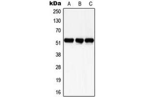 Western blot analysis of SMAD3 (pS204) expression in HeLa UV-treated (A), SP2/0 UV-treated (B), H9C2 UV-treated (C) whole cell lysates.