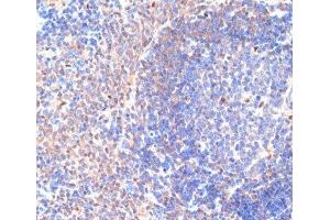 Immunohistochemistry of paraffin-embedded Rat spleen using CXCL12 Polyclonal Antibody at dilution of 1:100 (40x lens).